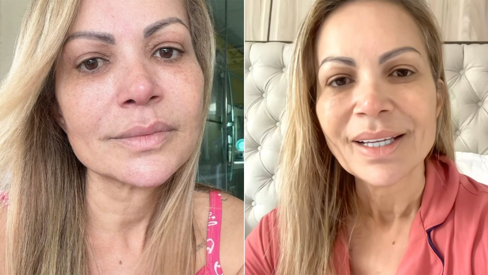 Motivo da cirurgia de Solange Almeida &#233; revelado. Saiba o que aconteceu