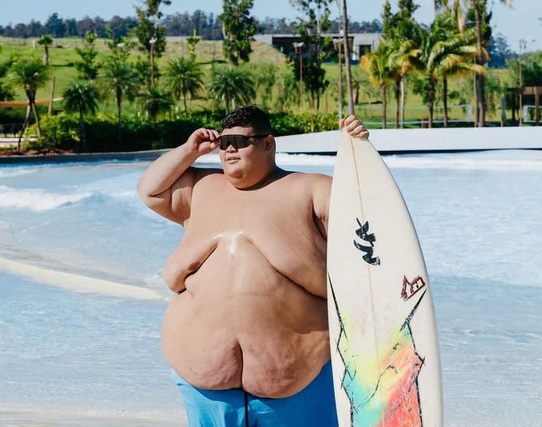 Gordão da XJ revela medo de ficar magro e perder seguidores